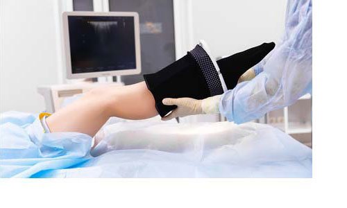 Doctor applying compression socks