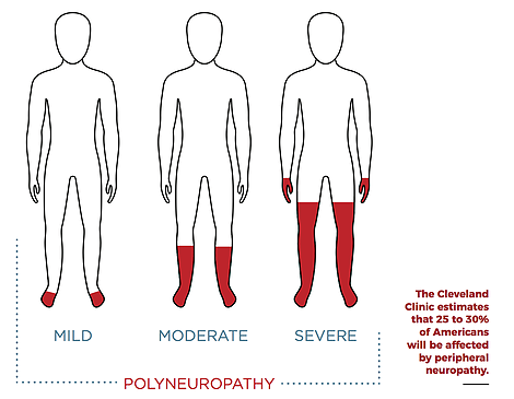 polyneuropathy
